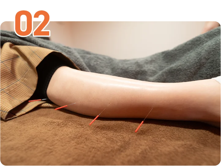 つづき接骨院・鍼灸院の選ばれる理由は接骨と鍼灸を組み合わせた施術